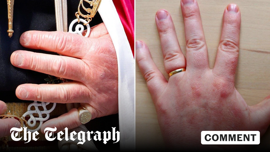 King Charles Hands